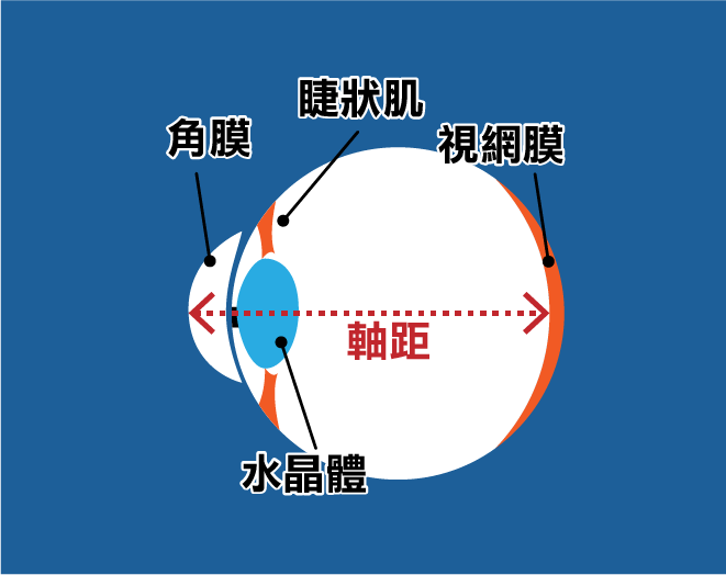 為什麼會近視,軸距是什麼?為什麼要戴控制鏡片?戴了可以回復視力嗎? - 製圖玩家